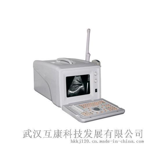 kx668(便携式)超声诊断仪